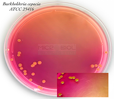 BURKHOLDERIA CEPACIA SELECTIVE AGAR (BCSA)