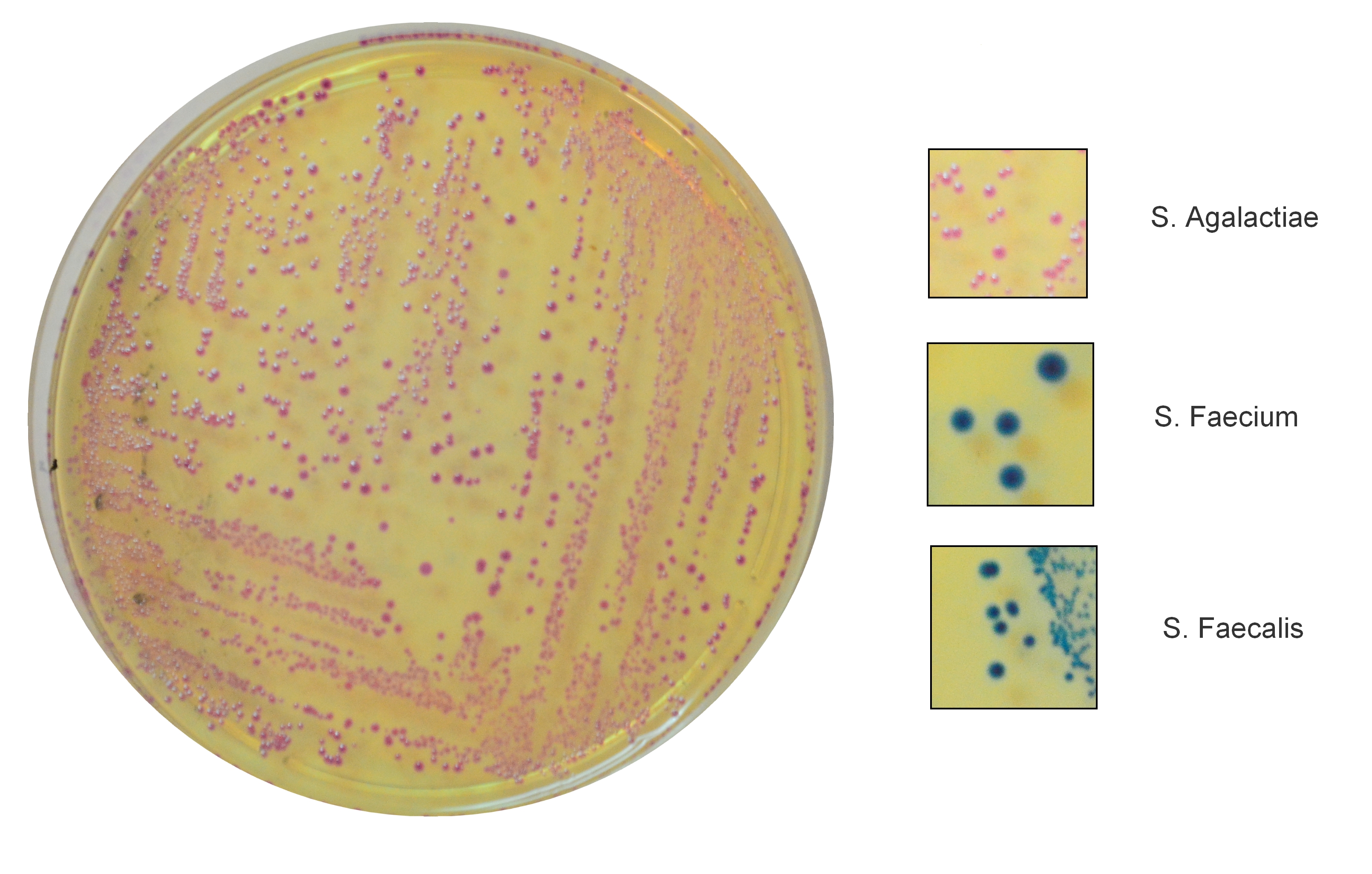 AGALACTIAE CHROMOGENIC AGAR