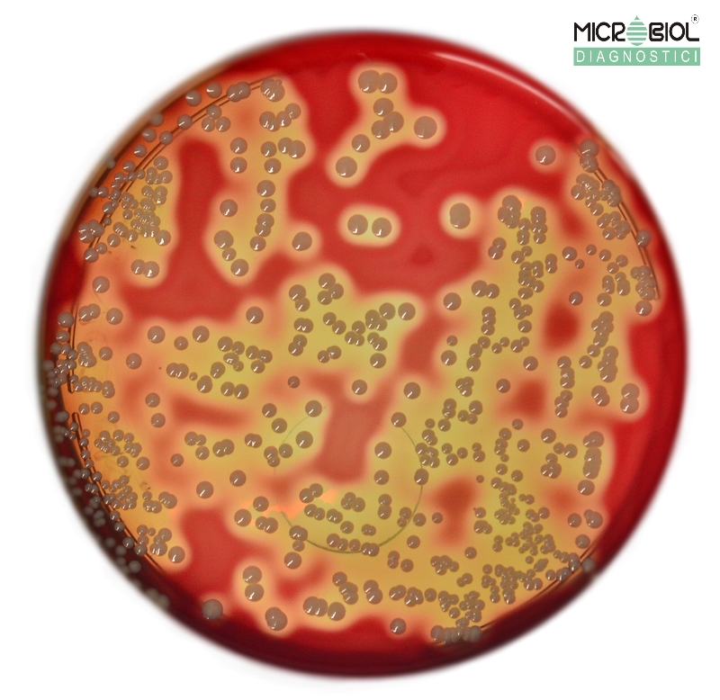 BLOOD AGAR BASE N2