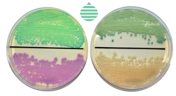 CANDIDA CHROMOGENIC AGAR