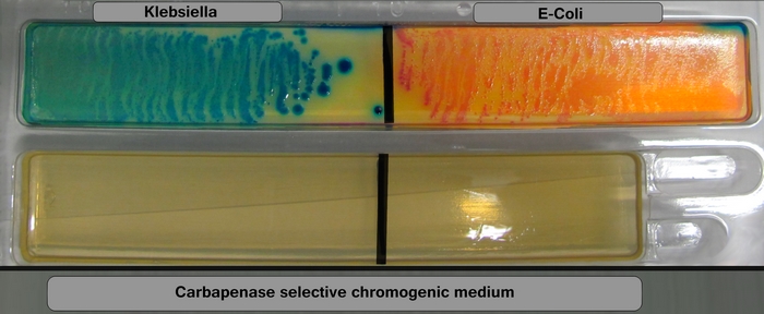 KP CHROM AGAR (carbapenase resistance)