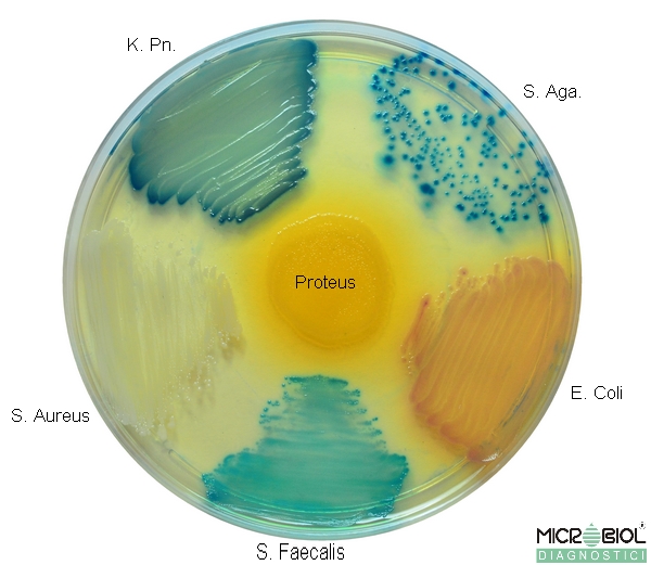 URI DIFFERENTIAL AGAR