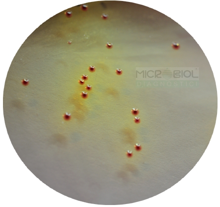 KF STREPTOCOCCUS AGAR