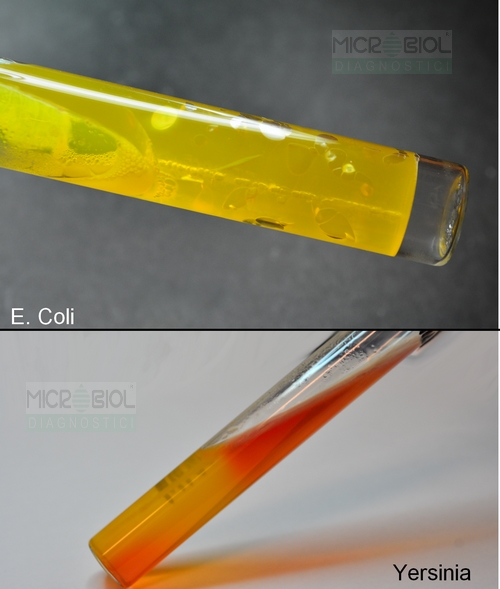 KLIGLER IRON AGAR