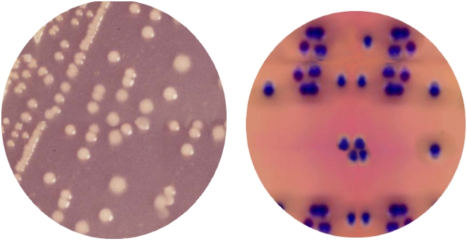 MAC CONKEY SORBITOL AGAR + BCIG