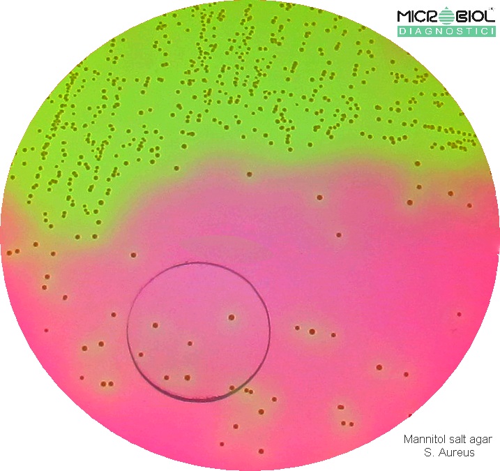 MANNITOL SALT AGAR