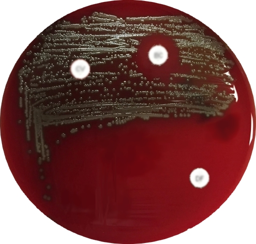 MUELLER HINTON AGAR 5% Sangue Montone