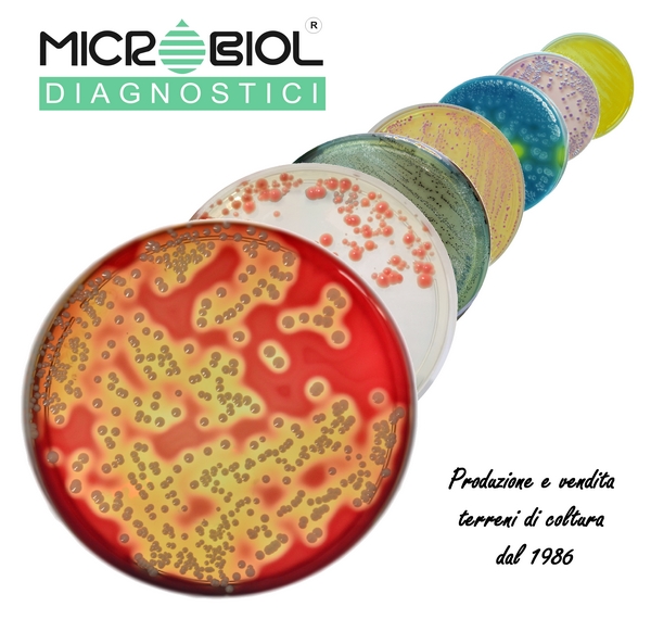 ENTEROCOCCUS CHROMOGENIC AGAR
